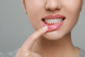 periodontitt